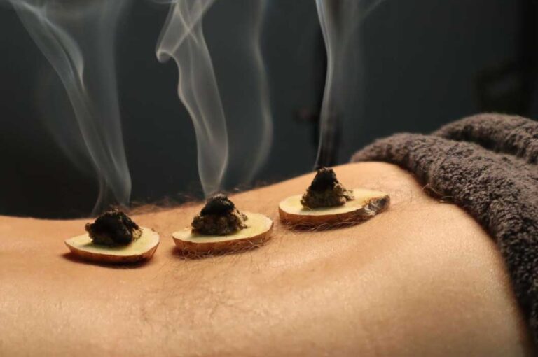 Moxibustion in der Schmerztherapie